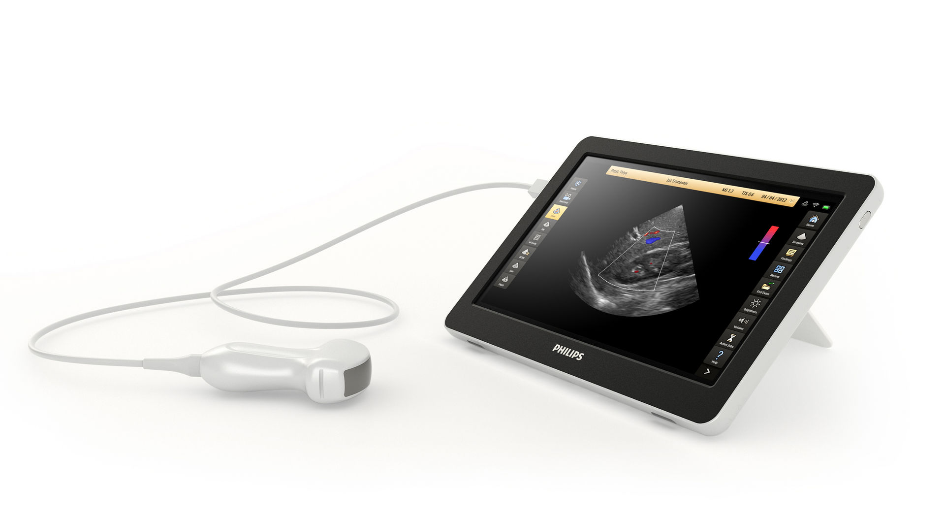 VISIQ portable ultrasound system