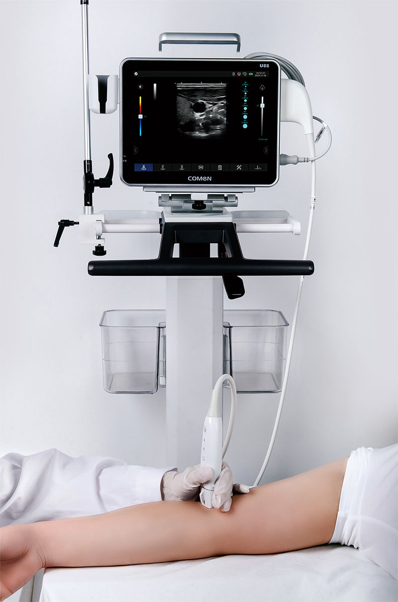 ECG Doppler Ultrasound System